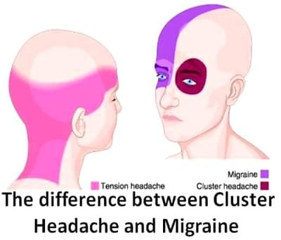 قرص میگراستیل MIGRASTIL 5 تفاوت میگرن و سردرد