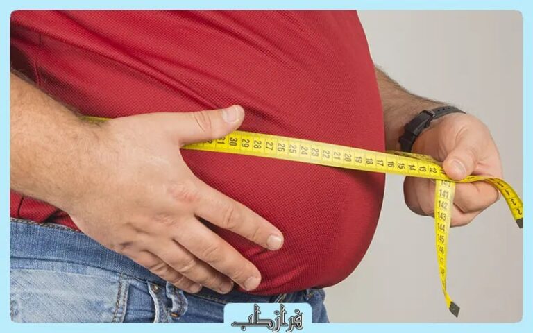 روش های کوچک کردن معده بدون جراحی