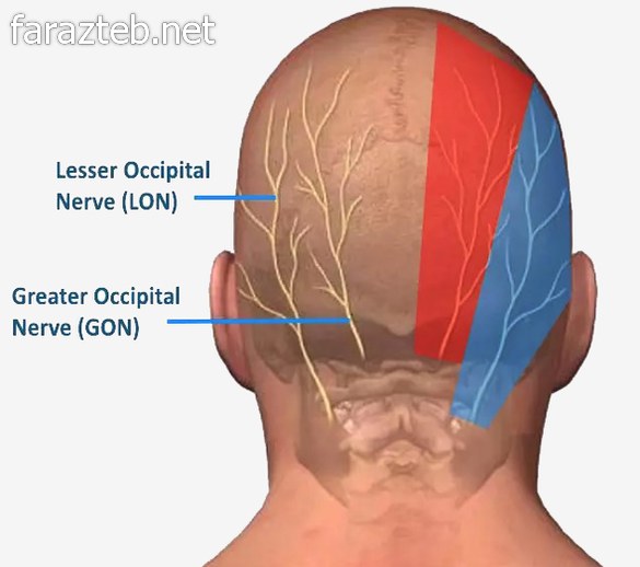 قرص میگراستیل Migrastil 2 میگرن عصبی روی مغز