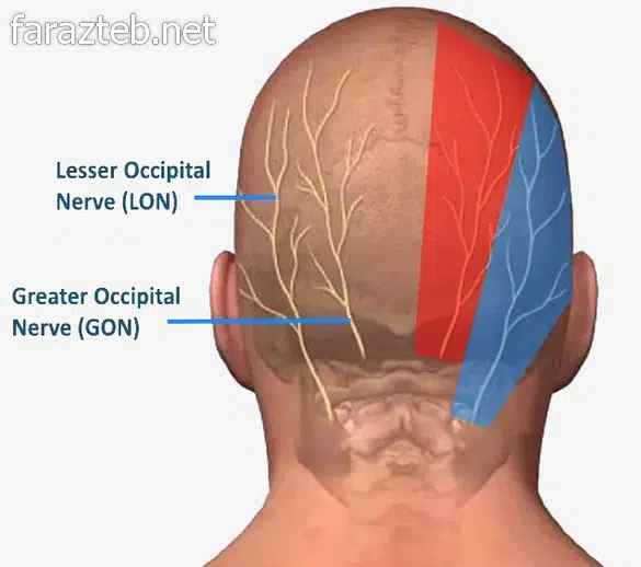قرص میگراستیل Migrastil 2 میگرن عصبی روی مغز
