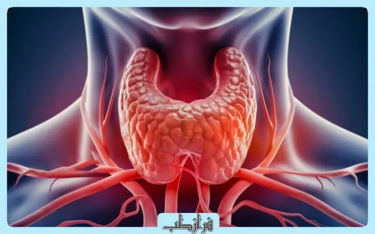 قرص لاغری برای افراد مبتلا به تیروئید