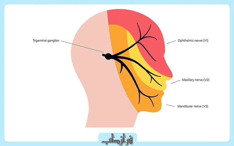 علائم میگرن عصبی چیست؟