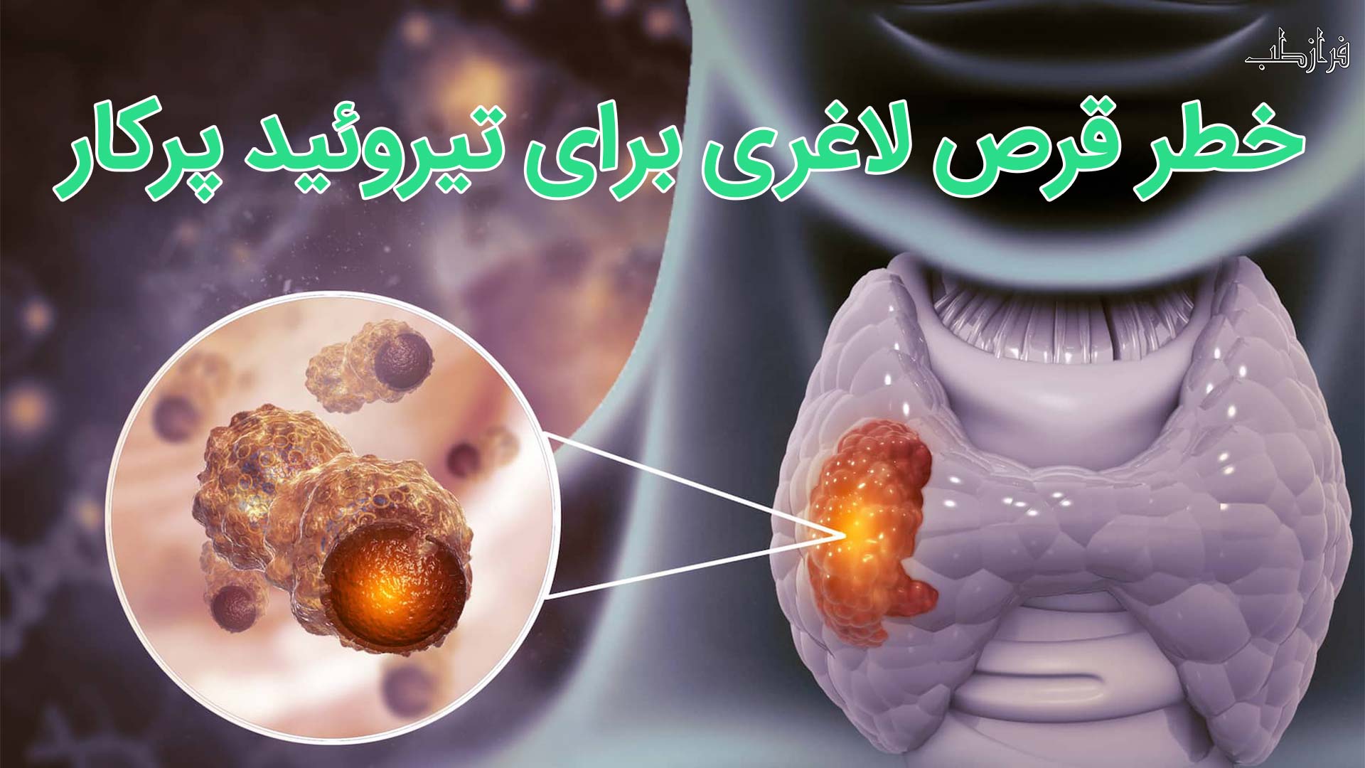آیا قرص لاغری برای تیروئید پرکار خطرناک است؟