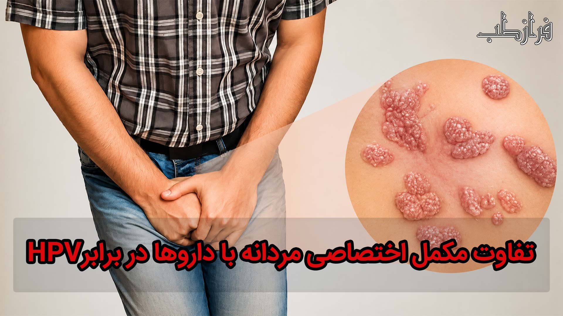 تفاوت مکمل اختصاصی مردانه با داروها در برابر HPV