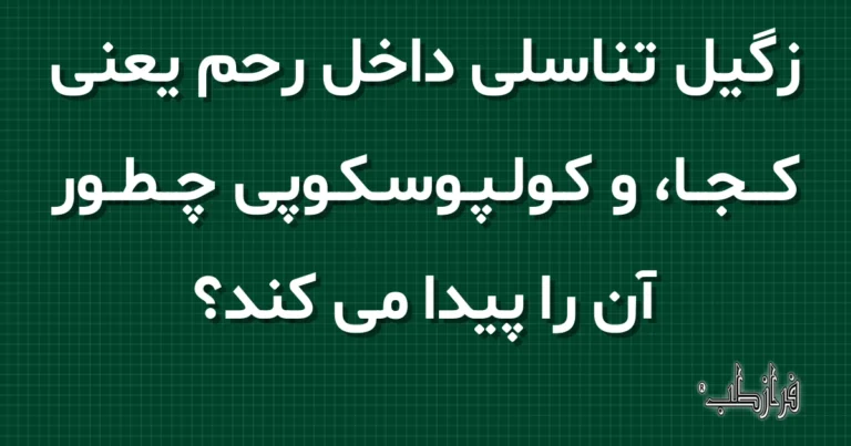 زگیل تناسلی داخل رحم یعنی کجا، و کولپوسکوپی چطور آن را پیدا می کند؟