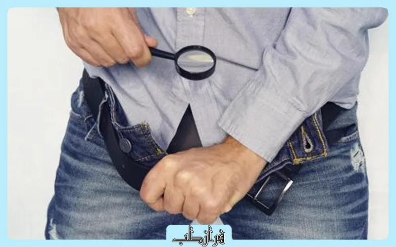 روش جلکینگی